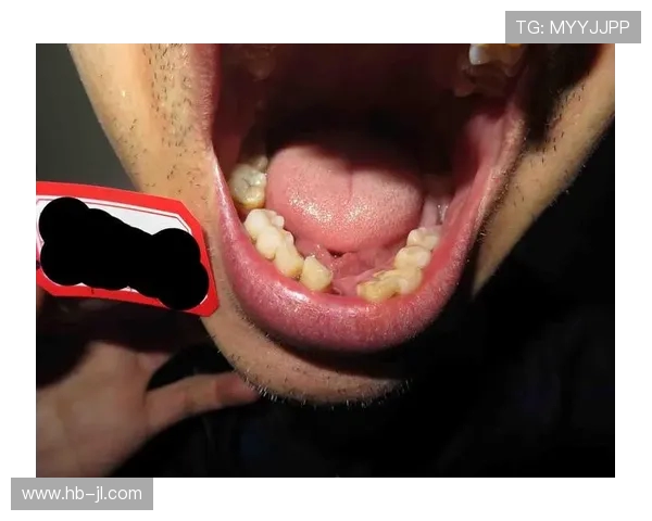 奇克遭遇重伤牙齿断裂与牙槽骨骨折预计缺阵数月